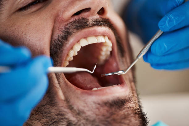 Best Pediatric Emergency Dentist in Rpinteria, CA