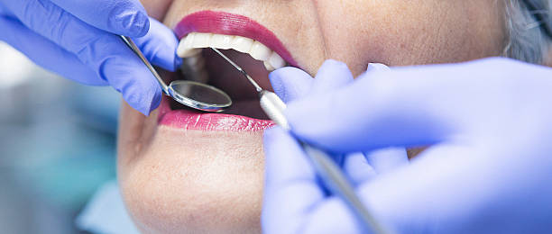 Best Emergency Dental Care for Broken or Chipped Teeth in Rpinteria, CA